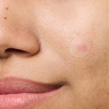 Mighty Patch™ Invisible+ patch